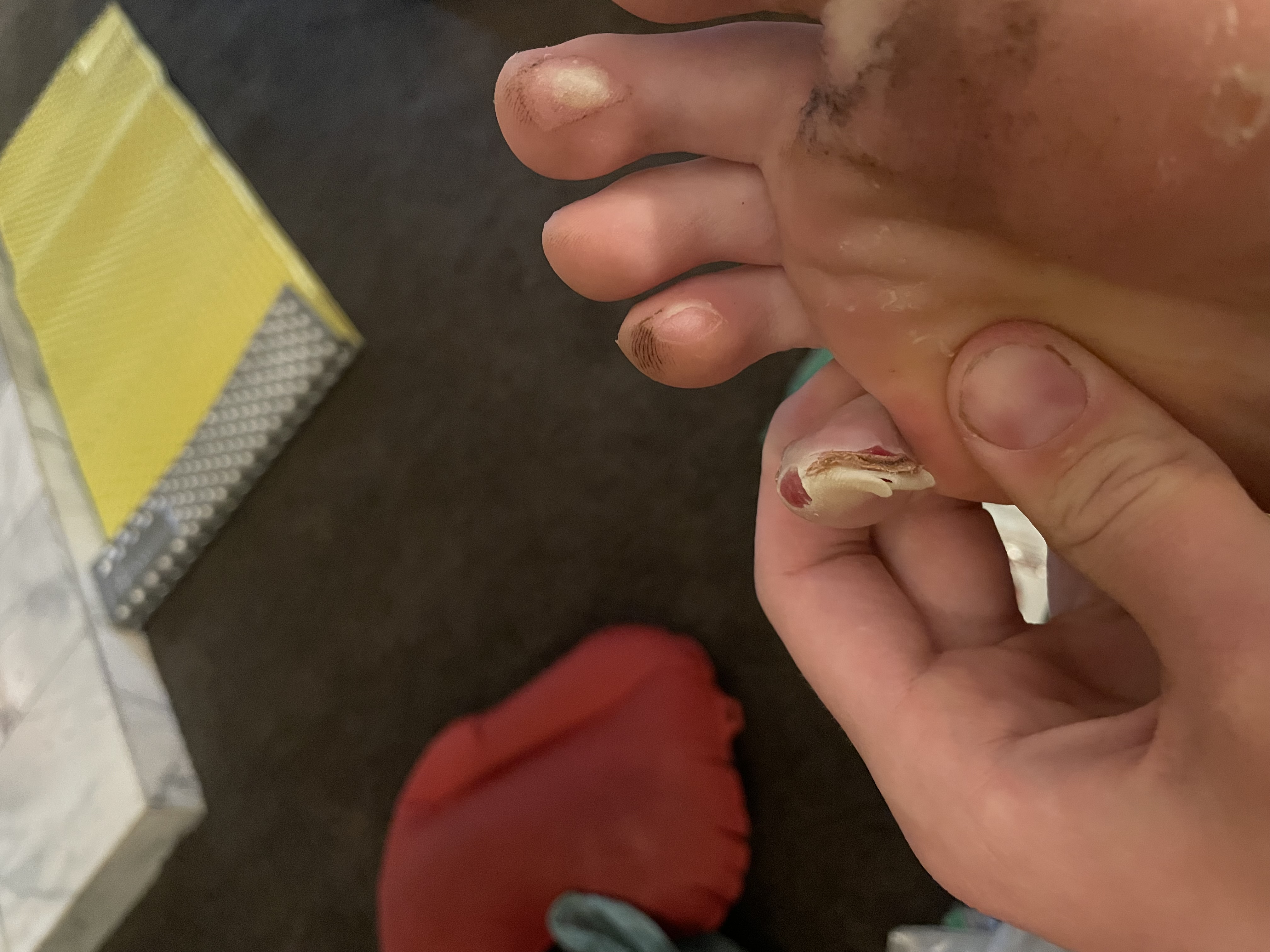 toe